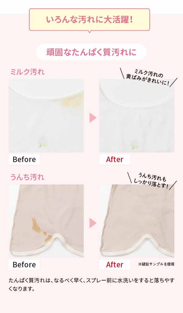 手ごわい汚れに泡でらくらくシミ対策